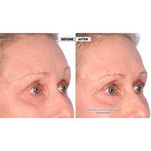 Active Argan 2-pack Resurface Super Size Resurfacing Serum Auto-Ship®