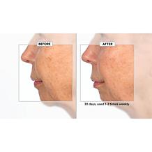 Active Argan Resurface Accelerating Peel Auto-Ship®