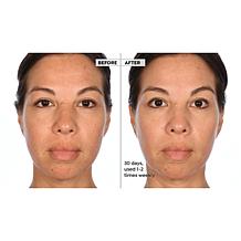Active Argan Resurface Accelerating Peel Auto-Ship®