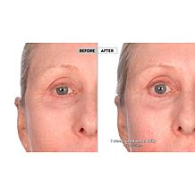Active Argan Resurface Super Size Resurfacing Serum