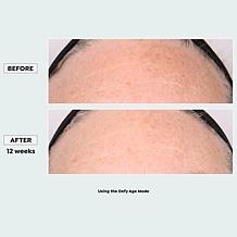 "As Is" Sharper Image Revel LED Light Therapy Face Mask