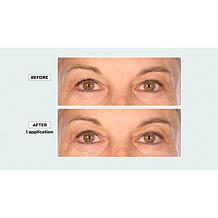 "As Is" Signature Club A RTC Infused Cool Tight Eye & Neck 2-piece Set