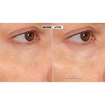 BeautyBio 2-pack The Eyelighter Brightening Serum