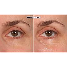 BeautyBio Eyelighter Concentrate & Bright Eyes Gels