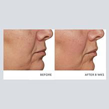 Beekman 1802 Milk RX Advanced Better Aging Cream 2-pack Auto-Ship®