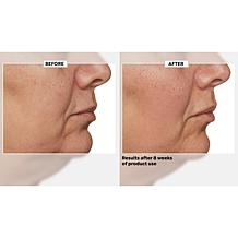 Beekman 1802 Milk RX Advanced Better Aging Renexosome Cream