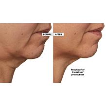 Beekman 1802 Milk RX Advanced Better Aging Renexosome Cream AS