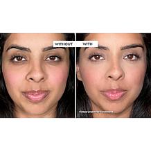 Doll 10 3-piece Doll Skin Genius Serum & Undereye Treatment Set