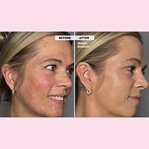 Doll 10 Peptide Bounce Foundation Set with Bag - Light AS