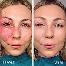 Doll 10 Supersize Reishi Radiance Foundation Set Auto-Ship®