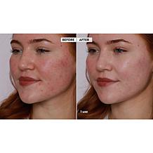 Doll 10 T.C.E Color Correcting Serum Stick 2-pack