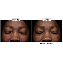 Dr. Brandt Glow Overnight Retinol Oil