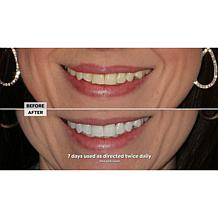 Intelliwhite Platinum Pen Whitening Kit Peppermint Auto-Ship®