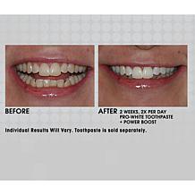 intelliWHiTE | Shop Teeth Whitening Kits, Toothpaste & Toothbrushes | HSN