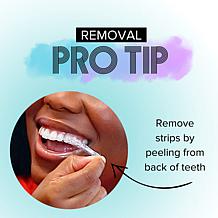 Intelliwhite Supersize Prostrips Teeth Whitening Kit Auto-Ship®