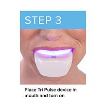 Intelliwhite TRIPULSE Teeth Whitening System Auto-Ship®