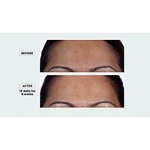 Isomers Retiniacin Night Renewing Treatment Serum