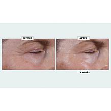 Isomers Skincare Expression Lines Peptide Booster Wrinkle Serum