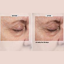 Isomers Skincare Fast Lift Eye Serum Set