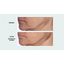 Isomers Skincare Matrixyl Hydration Boost Cream
