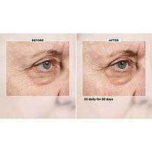 Isomers Skincare Multi-Corrective Fast Acting Eye Serum