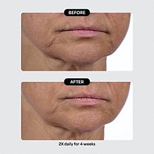 Isomers Skincare Special Edition Matrixyl Peptide Holiday Gift Set