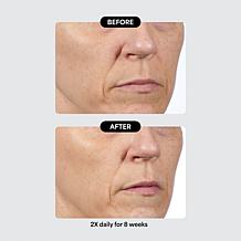 Isomers Skincare Special Edition Problem Solvers Holiday Gift Set