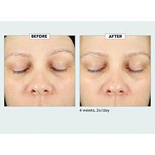 Kate Somerville KateCeuticals SuperCell Serum