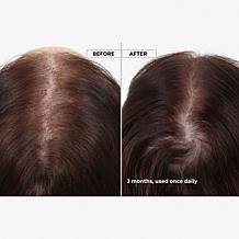 Keranique 120-Day Hair Regrowth Bundle Auto-Ship®