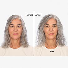 Keranique 120-Day Hair Regrowth Bundle Auto-Ship®