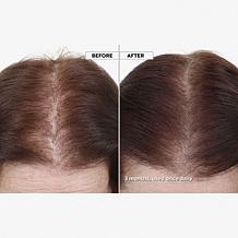 Keranique 120 Day Hair Regrowth Bundle