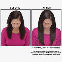Keranique 120 Day Hair Regrowth Bundle