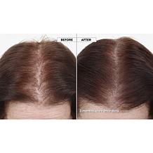 Keranique 120-Day Hair Regrowth Foam System with Scalp Massager