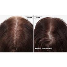 Keranique 120-Day Hair Regrowth Foam System with Scalp Massager AS