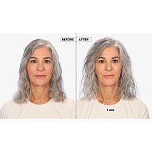 Keranique Hair Regrowth 60-Day Treatment w/ Scalp Massager