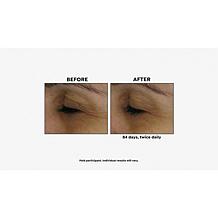 Korres 2-piece Black Pine Face & Eye Serum Set