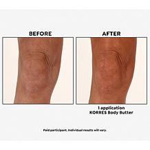 Korres White Melon ElastiSmooth Body Butter