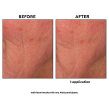 Korres White Pine Meno-Reverse Concentrate