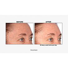 Lancôme Genifique Concentrate with Deluxe Sample