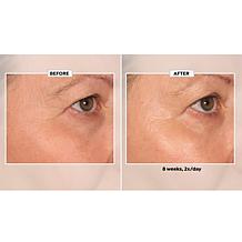 Lancôme Renergie Lift Multi Action Ultra Eye Cream