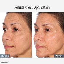 LUM OIL+LUMLIPOIL AS