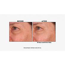 M. Asam Resveratrol NT50 Perfecting Eye Cream Auto-Ship®