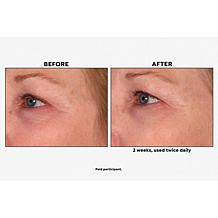 M. Asam VinoLift Skin Tightening Eye Balm 1.01 fl. oz.