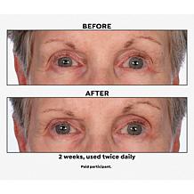 M. Asam VinoLift Skin Tightening Eye Balm 1.01 fl. oz.