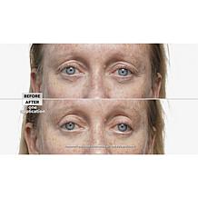 My Perfect Eyes .35 oz. Undereye Fix