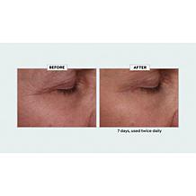 Nakery Beauty 2-pack Lift-TOX 360 Firming Eye Lift Treatment