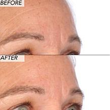 Nakery Beauty 2-Piece Supersize Firm + Lift Collection - Auto-Ship®