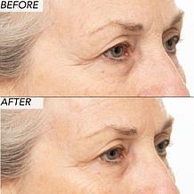 Nakery Beauty 2-Piece Supersize Firm + Lift Collection