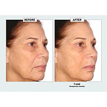 Nakery Beauty Advanced Instant Wrinkle Eraser