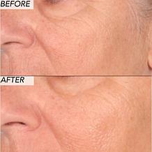 Nakery Beauty Advanced Resurfacing Microderm Scrub